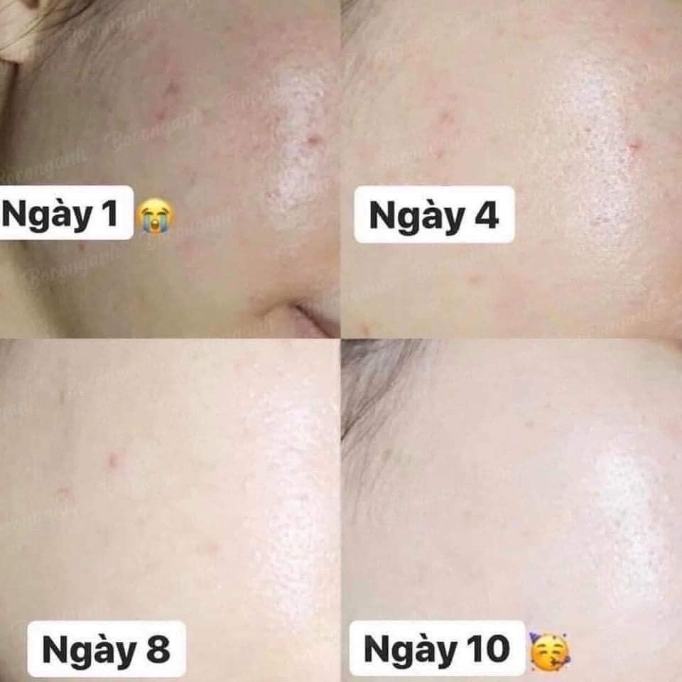 Kem dưỡng trắng da Medipeel Glutathione 50g