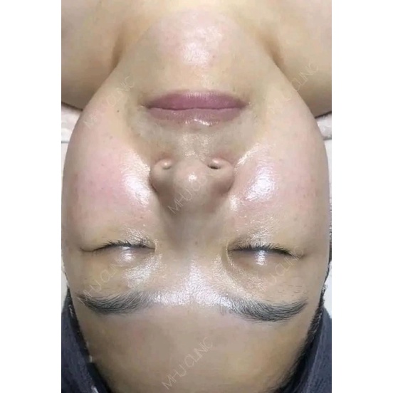 Tinh chất dưỡng trắng da căng bóng trẻ hoá da tức thì  janssen Brilliance Shine Elixir platinum care FULL HỘP 25 ỐNG