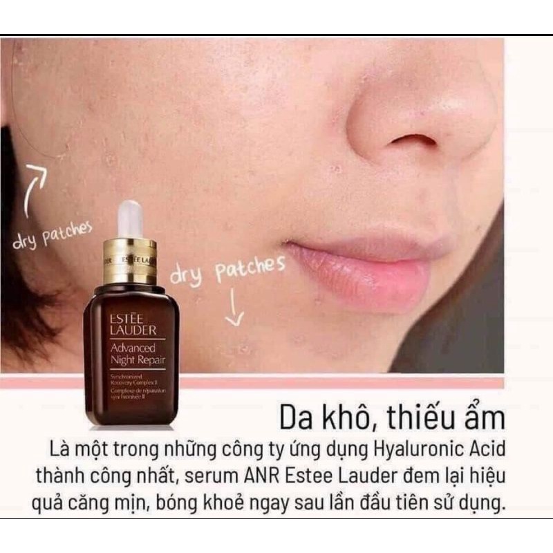Serum Estee Lauder Advanced Night Repair, Tinh chất phục hổi da chống lão hóa Estee Lauder ARN 15ml