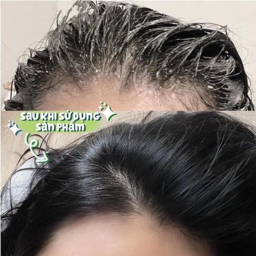 Cafe Mimi Shampoo Scrub Tẩy Da Chết Dành Riêng Cho Da Đầu - 330g