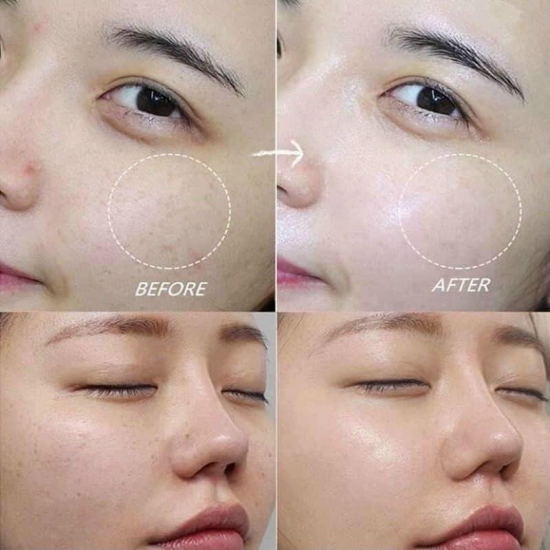 Tinh Chất Mờ Nám, Trắng Da Dongsung Miskos Whitening 100ml