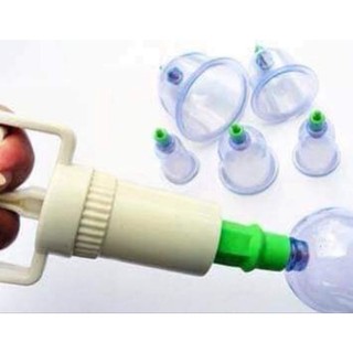 BỘ GIÁC HƠI 12 MÓN KHÔNG DÙNG LỬA