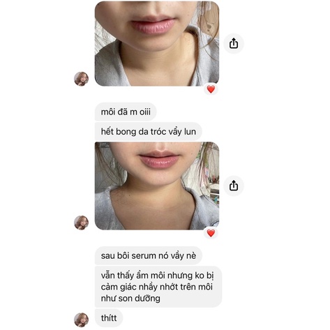 SERUM DƯỠNG MÔI / 𝑬̂𝒎 𝑴𝒐̣𝒏𝒈