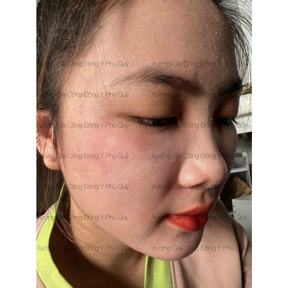 Kem Tái Tạo My My Vip Chuẩn Spa Tặng Kích Bong