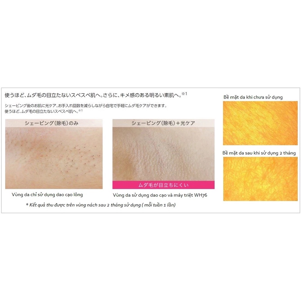 Máy triệt lông Panasonic EH WH76