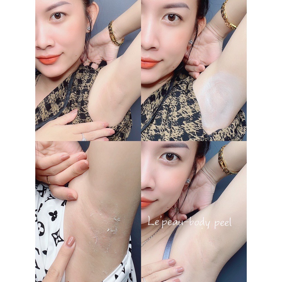 Peel nách retinol, peel chân, khử thâm và làm trắng da Lepeau chính hãng