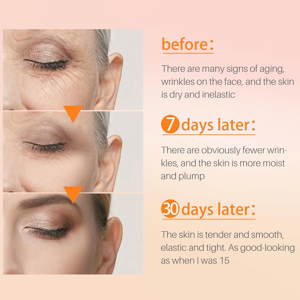 Serum 2.5% Retinol Chống Lão Hóa Dưỡng Ẩm Nâng Cơ X4P2