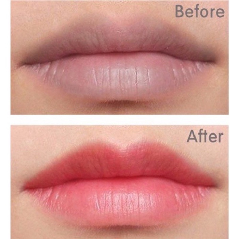 Combo Dưỡng Cấy Màu Môi Tế Bào Gốc Thiên Di Tẩy Thâm Môi Cấy Hồng Môi Tự Nhiên Kích Màu Phun Xăm