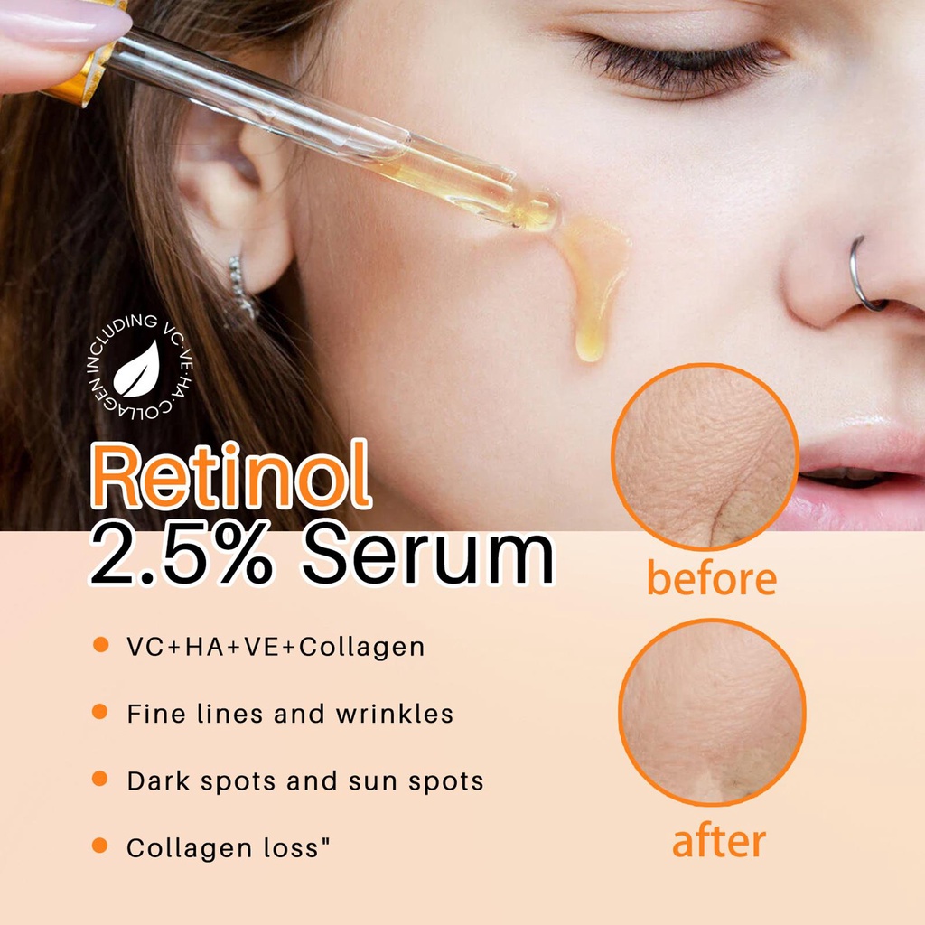 Serum 2.5% Retinol Chống Lão Hóa Dưỡng Ẩm Nâng Cơ X4P2