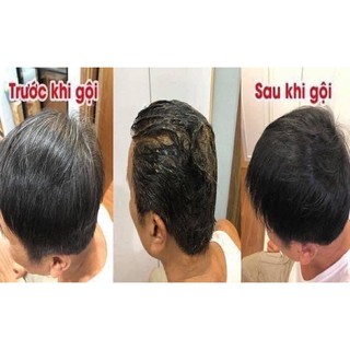 𝐃ầ𝐮 𝐆ộ𝐢 Đ𝐞𝐧 𝐓ó𝐜 𝐒â𝐦 𝐕à𝐧𝐠 + Olive ( 𝐇ộ𝐩 𝟏𝟎 𝐠ó𝐢)