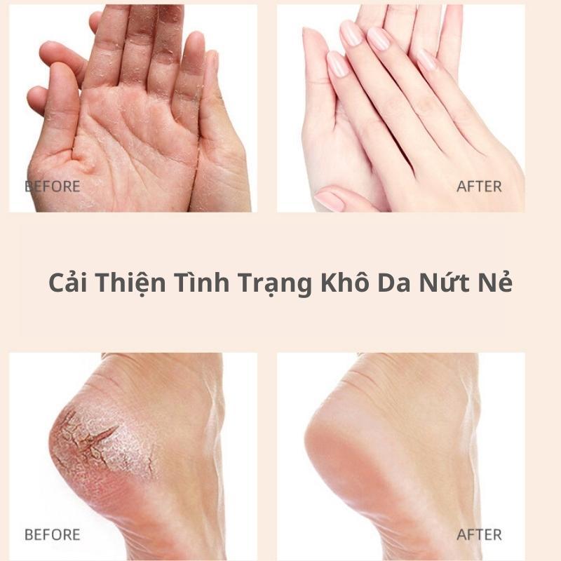 Kem nứt nẻ gót chân dưỡng trắng mềm da hết nẻ chân, nẻ tay tay đầu gối tẩy da chết chân Heyxi
