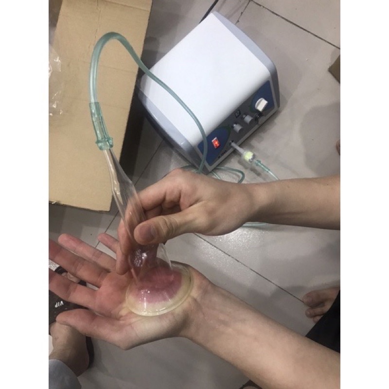  Ống thuỷ tinh hút ngực dùng trong máy thông tắc tia sữa 