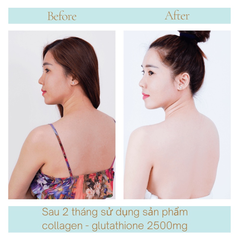 Trắng da COLAGEN -GLUTATHIONE 2500MG viên uống nâng tone cấp tốc đẹp da giảm nám tàn nhang tăng nội tiết