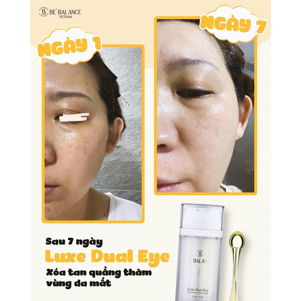 [HET HANG] Kem Mắt Be'Balance Luxe Dual Eye (30ml)