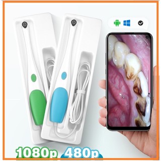 Camera nội soi tay cầm cho nha khoa răng hàm miệng,soi da,soi tóc tiện ích