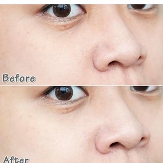 Serum Bakuchol 0,5% ..
