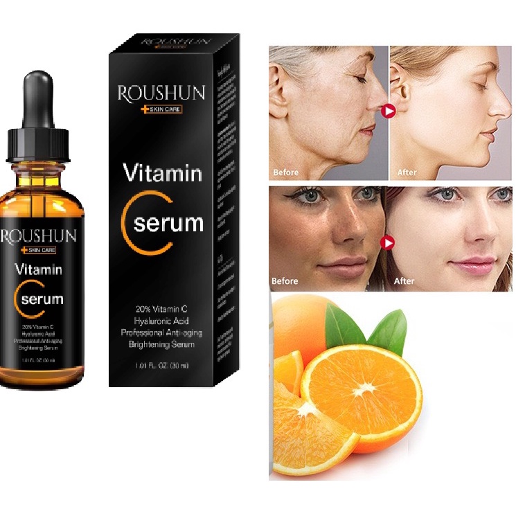 Serum Vitamin C Siêu Dưỡng Trắng, Hết Nhăn, Giảm Mụn, Trẻ Hóa Da, Giúp Da Đều Màu, Giảm Thâm Mắt, Chống Nám, Tàn Nhang