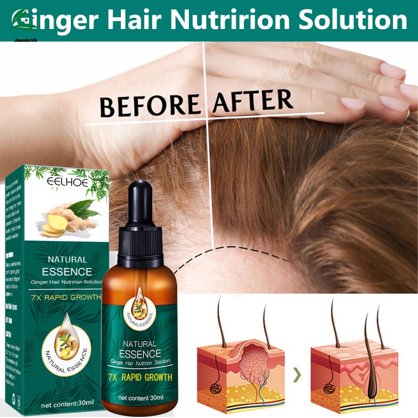 Tinh chất kích thích mọc tóc tự nhiên 30ml chất lượng