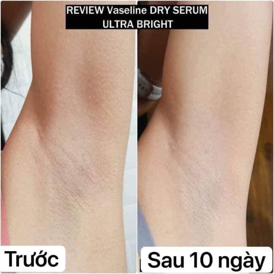 Kem dưỡng da khử mùi vùng nách Vaseline 45ml