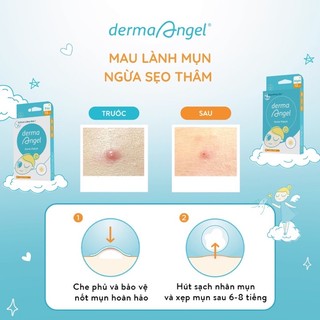 Miếng Dán Mụn Derma Angel Patch
