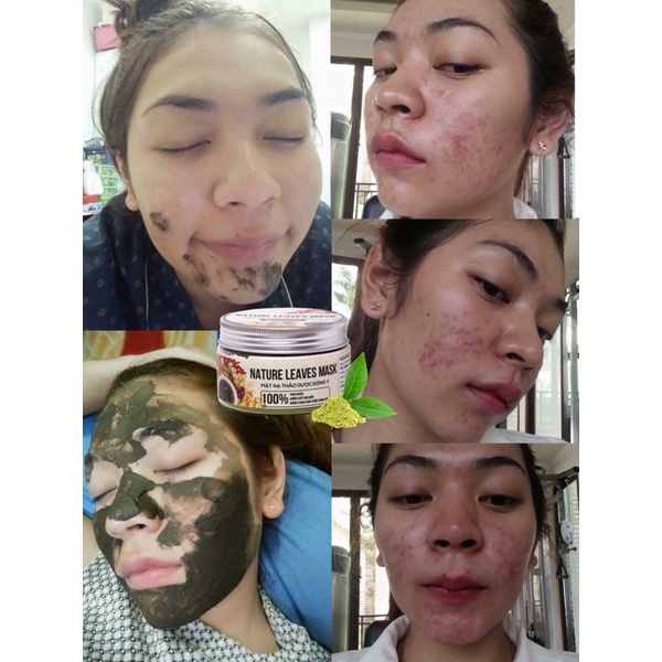 MẶT NẠ THẢO DƯỢC 3 TẦNG