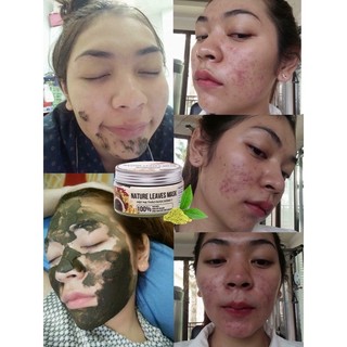 MẶT NẠ THẢO DƯỢC 3 TẦNG