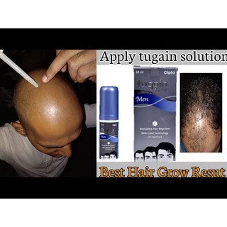Xịt Mọc Tóc Tugain Men Solution Minoxidil 5% , 0.1% Finasteride Lọ 60ml