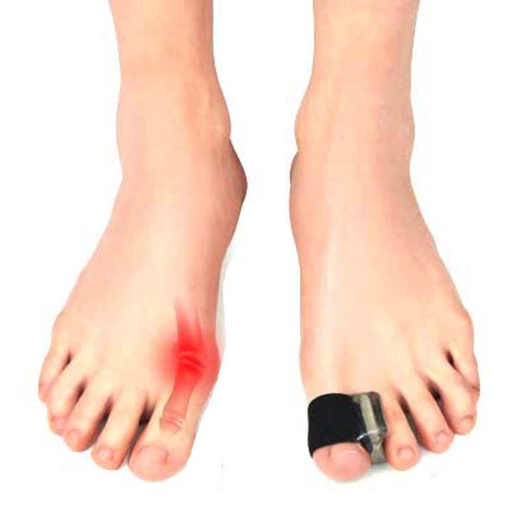 Dụng Cụ Chỉnh Hình Ngón Chân Cái Thoải Mái