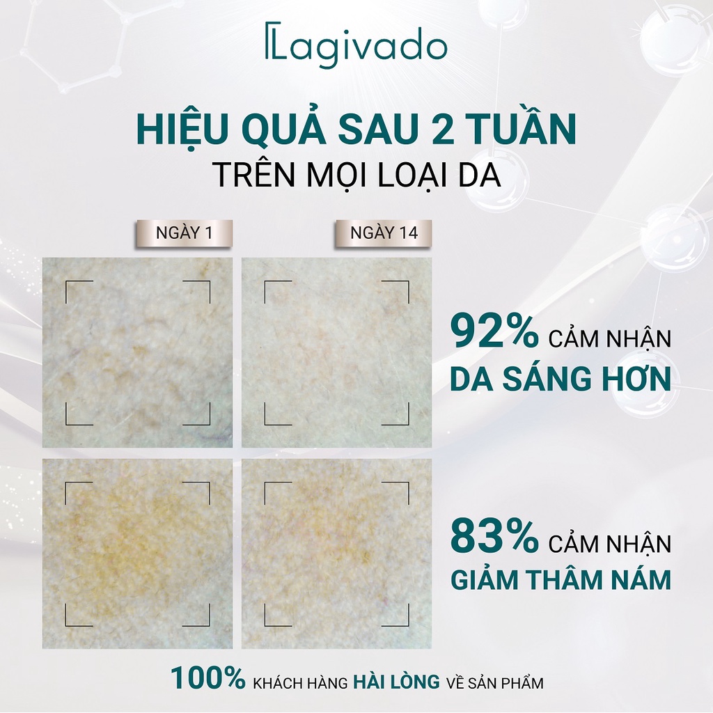 Bộ sản phẩm dưỡng trắng và làm sạch, mờ thâm nám, đốm nâu Lagivado (Cream 50 g + SRM 200ml)