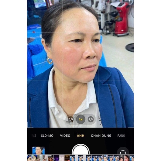 Kem Dưỡng Da Perfect Melasma Mờ Thâm, Nám, Sạm, Tàn Nhang, Dưỡng Trắng Da Hiệu Quả