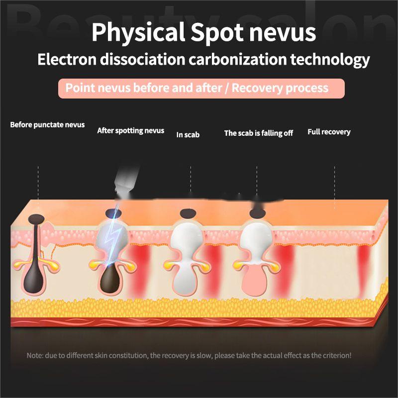 Bút Laser Plasma Xóa Tàn Nhang / Nốt Ruồi / Mụn / Hình Xăm Tiện Dụng