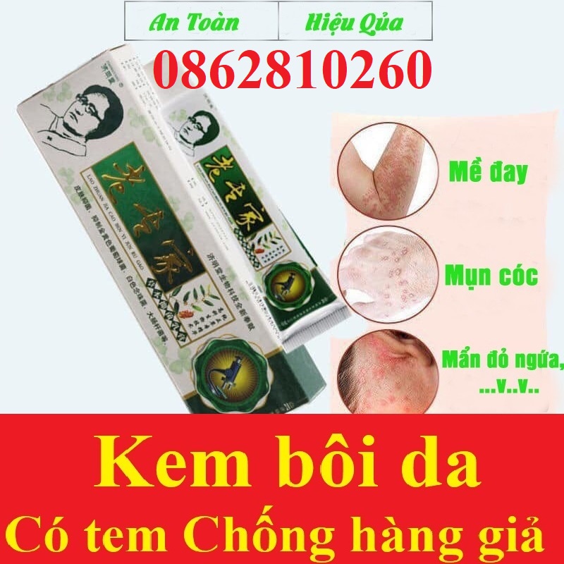 Kem bôi ngoài da hỗ trợ nấm ngứa, chàm, tổ đỉa, ghẻ nước...