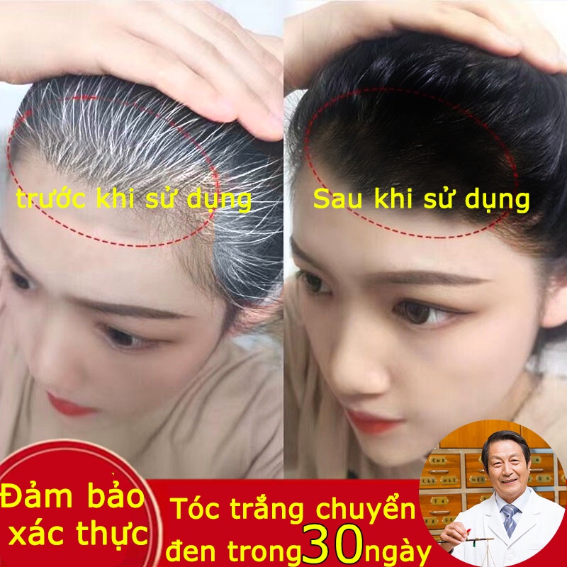 Dầu gội mọc tóc Dầu gội thảo dược kích thích mọc tóc sạch gầu, chứa biotin ngăn rụng tóc linh chi đen 300ml