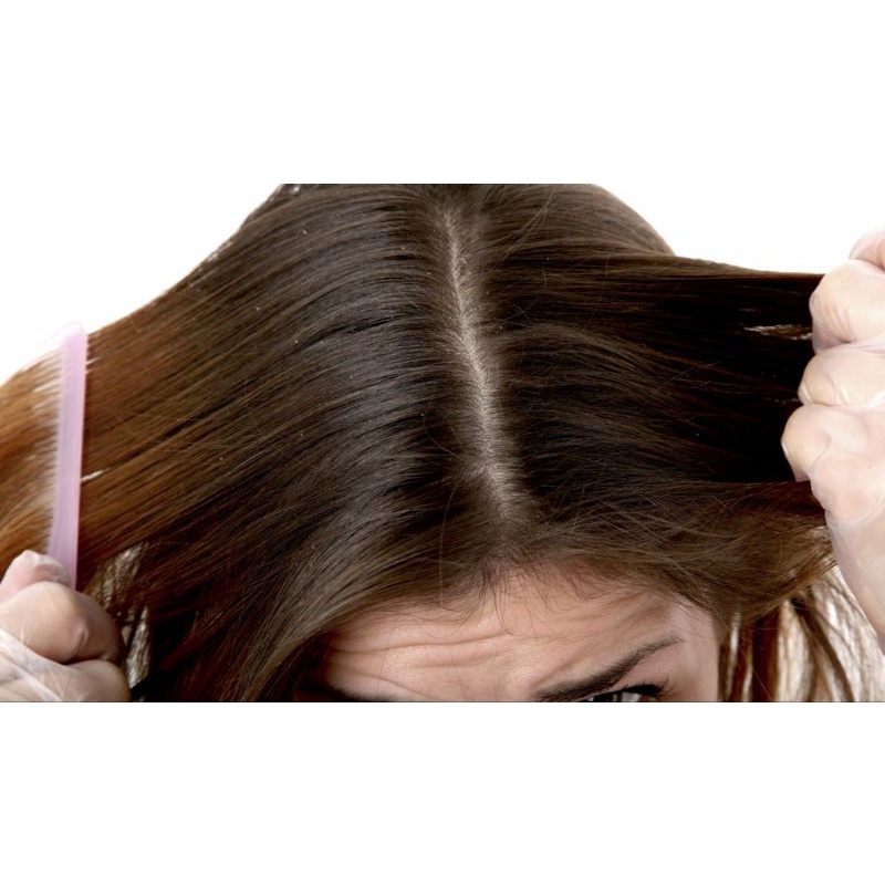 Dầu gội đầu phòng tránh Chí F&L