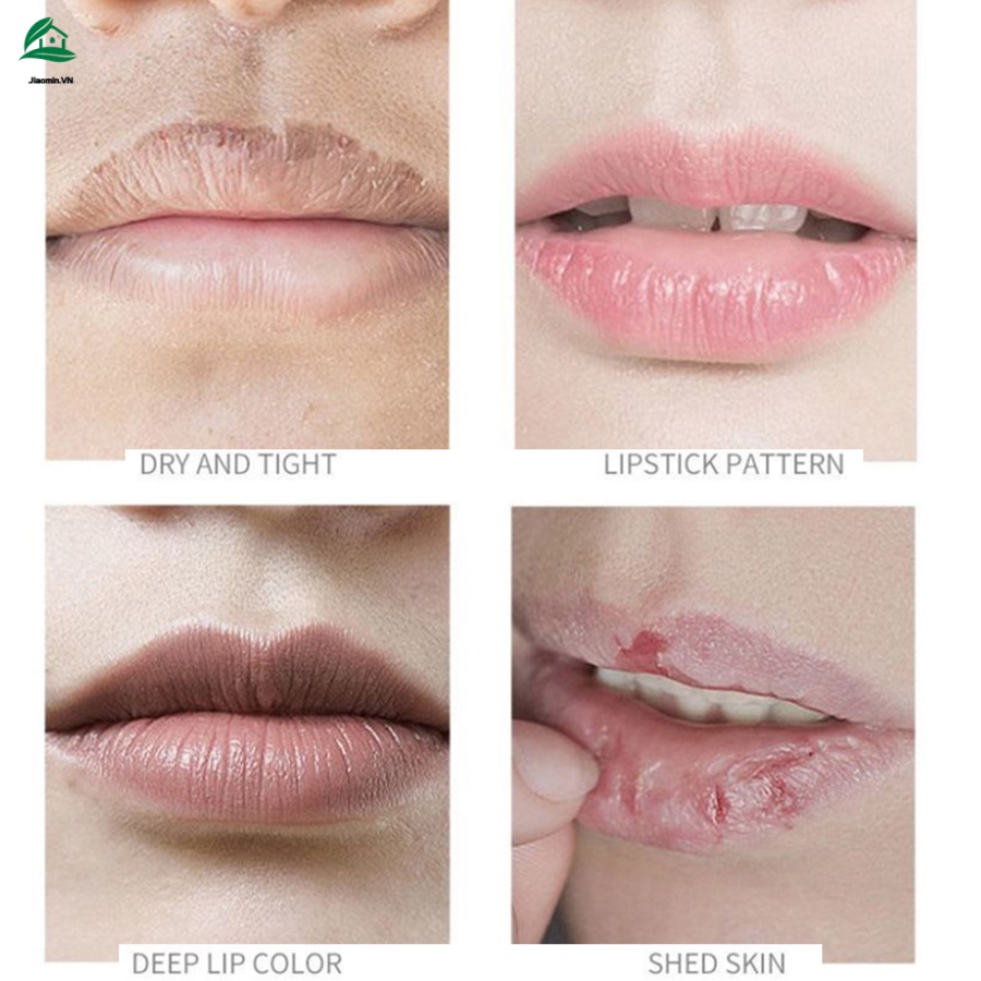 Gel Tẩy Tế Bào Chết Toàn Diện Dưỡng Ẩm Cho Môi