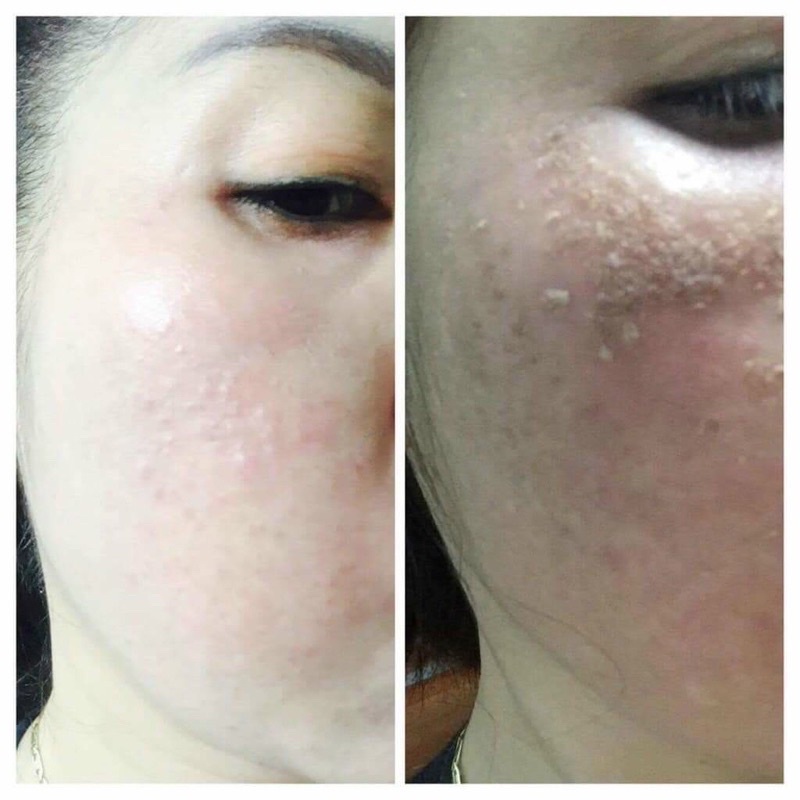 Kem tái tạo sâm tươi cao cấp,20gr căng bóng trắng mịn se khít lỗ chân lông handmade