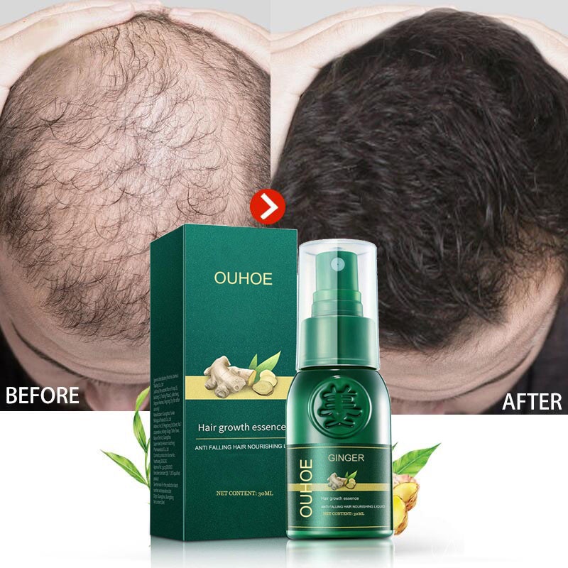 Chai Xịt Tinh Dầu Gừng Kích Thích Mọc Tóc Và Chống Rụng Tóc Cho Nam Và Nữ