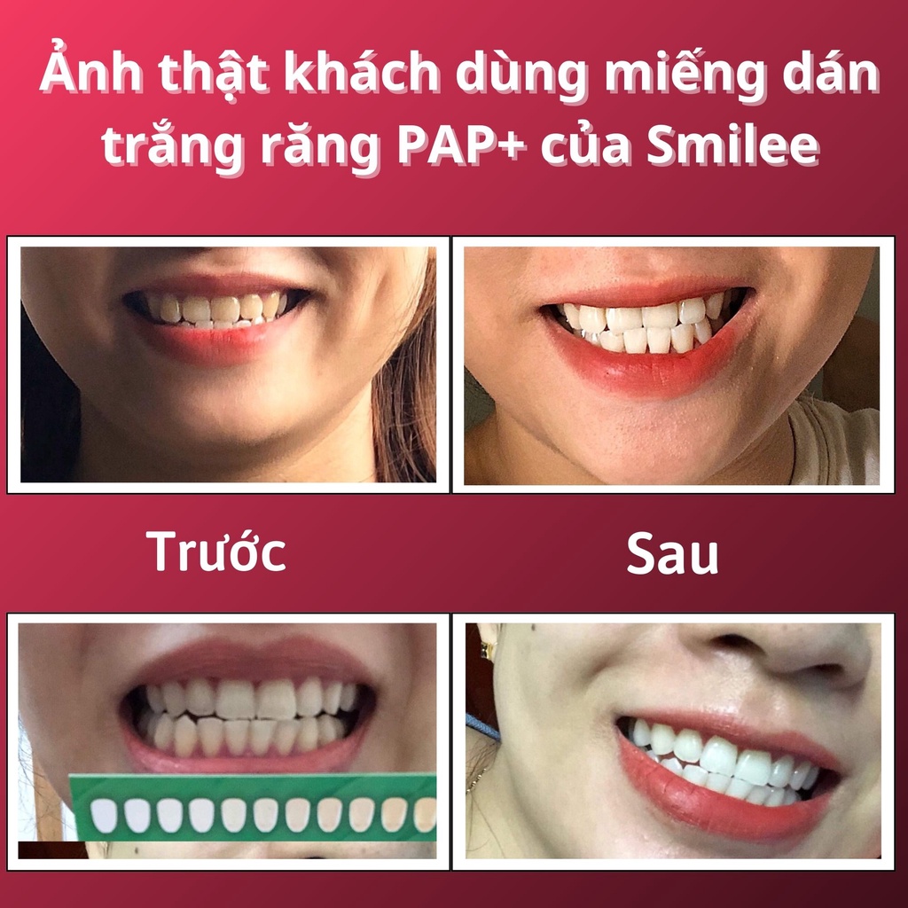 Miếng Dán Trắng Răng Smilee, Công nghệ PAP + Giúp Làm Trắng Răng Chỉ Sau 1 Lần Sử Dụng