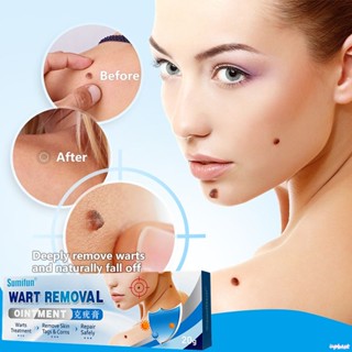 ♕Sumifun Gel Tẩy Mụn Cóc Thuốc Mỡ Loại Bỏ Thẻ Da Dụng Cụ Tẩy Nốt Ruồi Chăm Sóc Cơ Thể Chân Mặt Loại Bỏ Mụn Cóc Mụn Cơm Cơ Thể Thảo Dược Hữu Cơ Tự Nhiên Trị Liệu Y Tế 20G Upbest