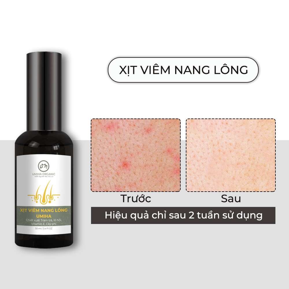 Xịt viêm nang lông mụn thâm UMIHA (50ml) - x2 hiệu quả ngừa viêm nang lông, ngừa mụn, trắng da với BHA và Nano Bạc