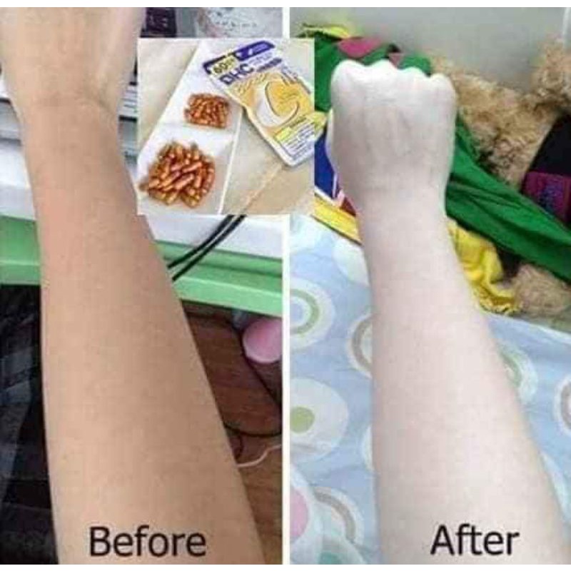 Viên uống bổ sung Vitamin C Nhật Bản Dưỡng Sáng Da Mờ Thâm Nám Gói 120v (60 ngày)