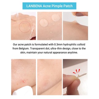 Miếng dán mụn Lanbena Breylee Acne Pimple Patch