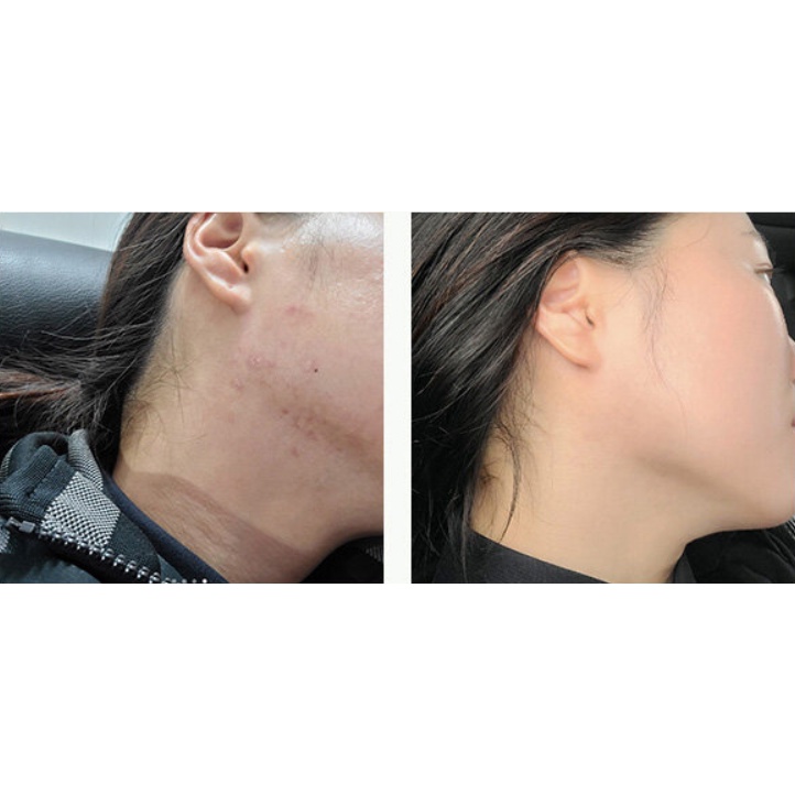 Bộ Serum Đặc Biệt Nosca 9 Trouble