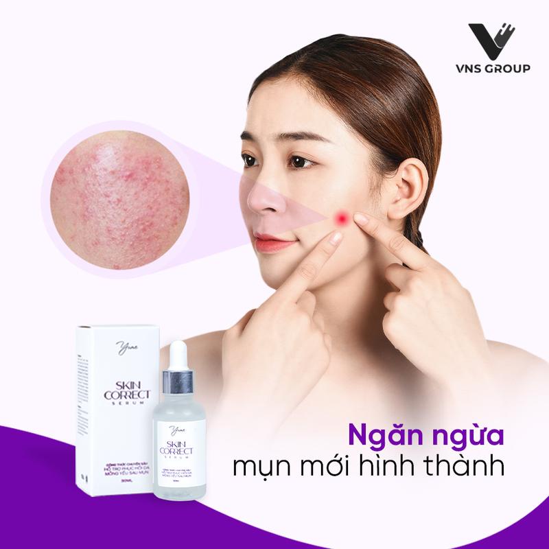 Tinh chất Skin Correct Serum VNS Group dưỡng ẩm và phục hồi da mỏng yếu 30ml