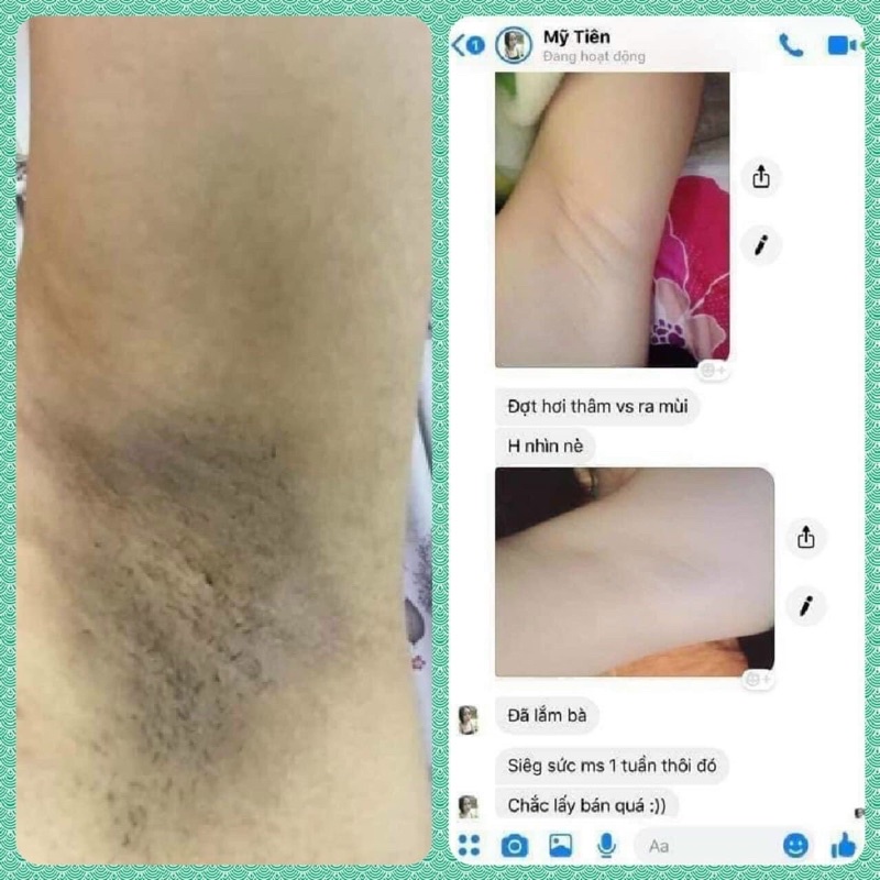 Kem Loại Bỏ Mùi HÔI NÁCH Cô Bơ lọ to 30gr, ngăn tiết mồ hôi, giúp giảm thâm nách chiết xuất từ thiên nhiên