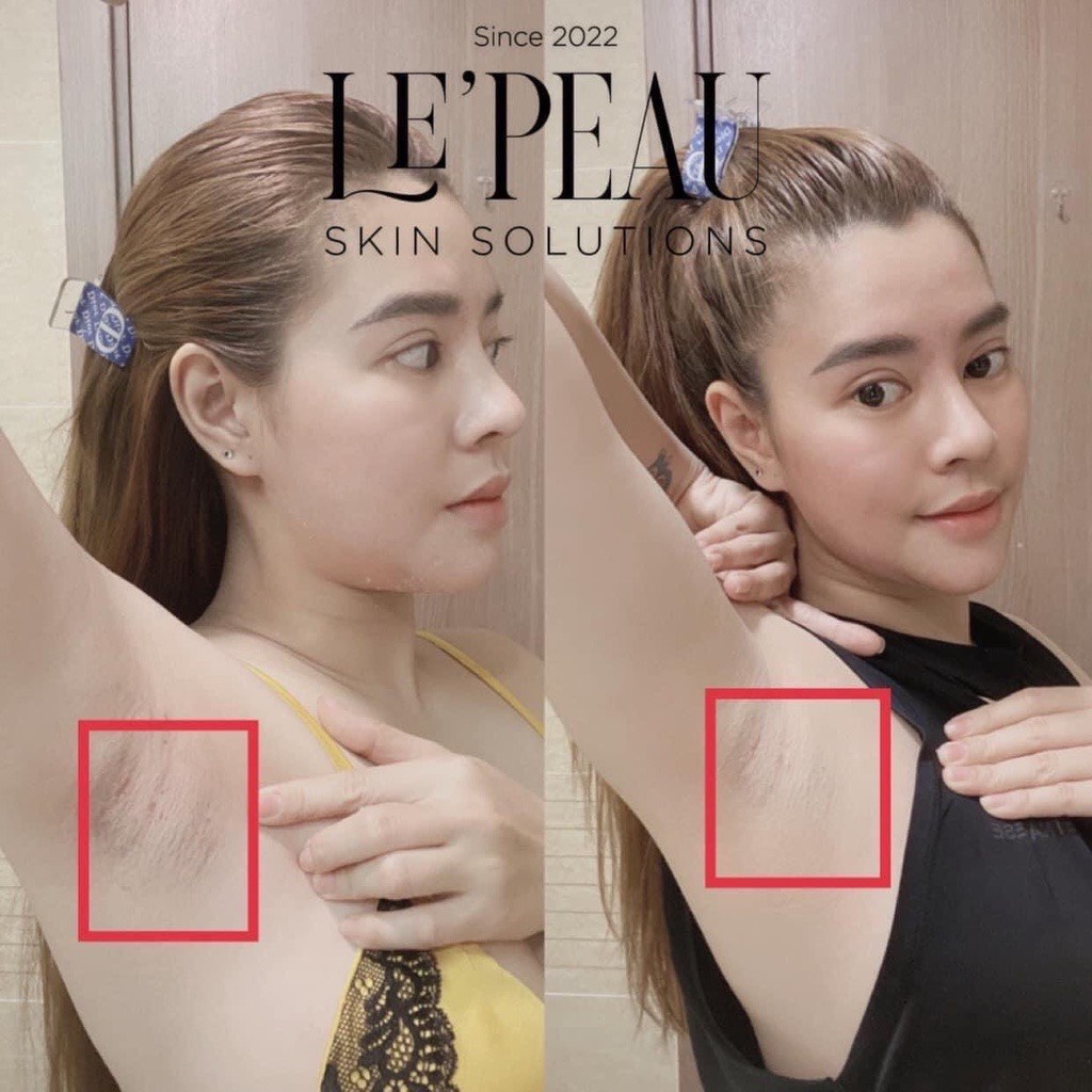 Peel nách retinol, peel chân, khử thâm và làm trắng da Lepeau chính hãng