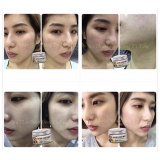 MẶT NẠ THẢO DƯỢC 3 TẦNG