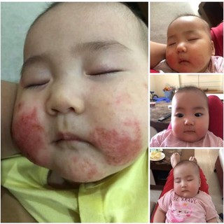 4 lọ kem mỡ minh hùng