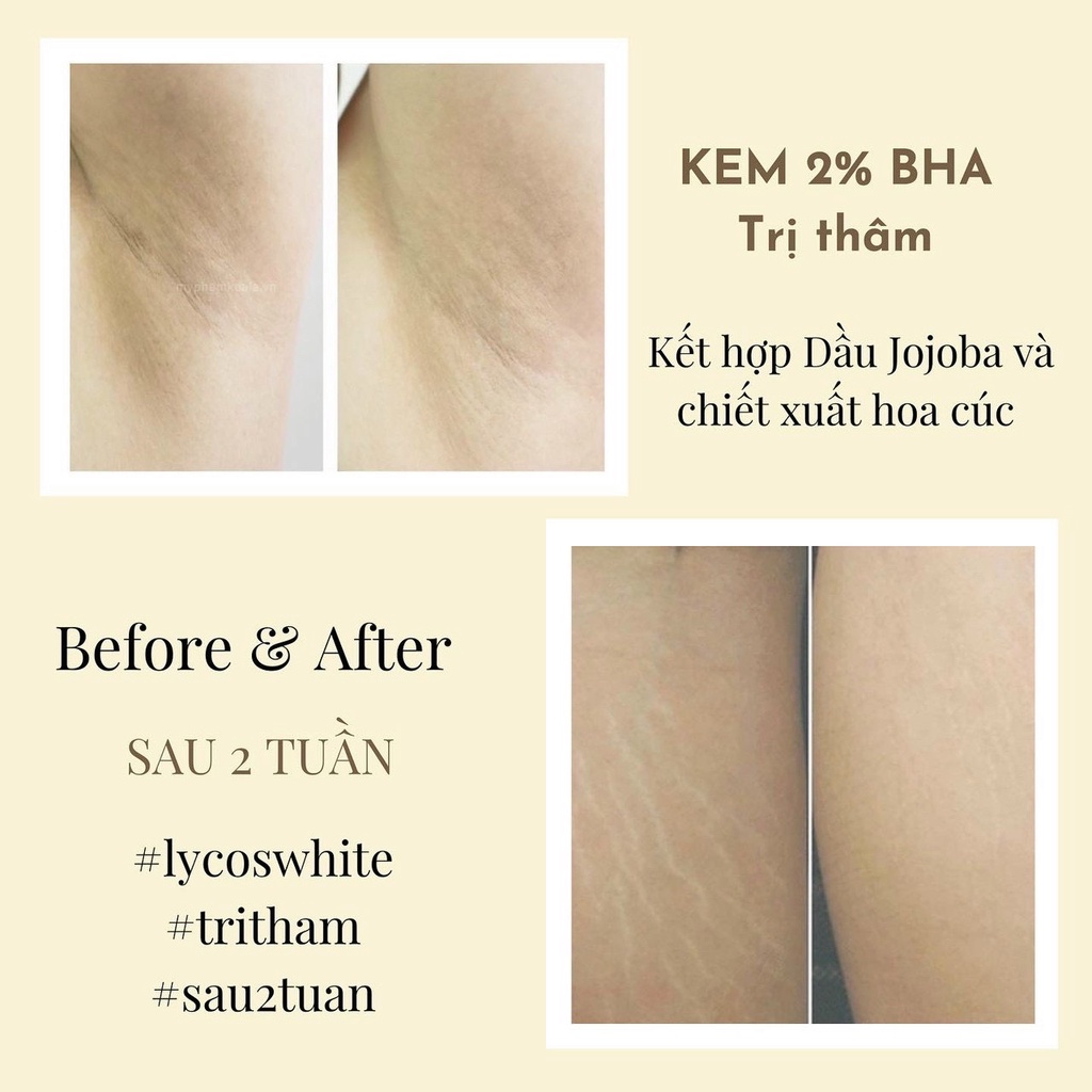 Kem 2% BHA Mờ Thâm Chiết Xuất Hoa Cúc & Dầu Jojoba Lycos White