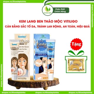 Kem lang ben thảo mộc VITILIGO - Cải thiện da nấm lang ben, không gây kích ứng, ngăn chặn lan rộng, cân bằng sắc tố da